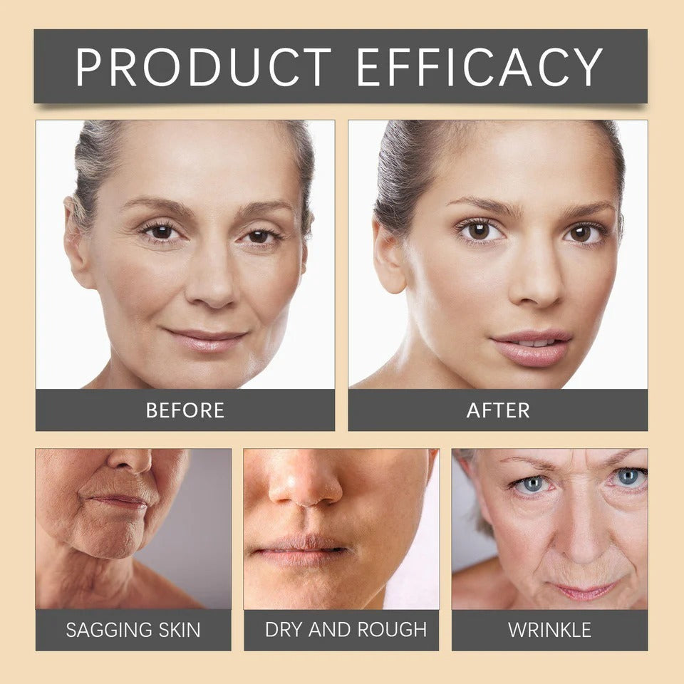 Botox Bee Venom Whitening & Moisturizing Cream – Anti-Aging, Brightening & Skin Firming