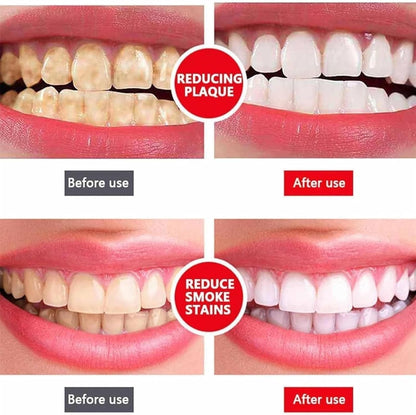 Yayashi Sp-4 Ultra Whitening Toothpaste